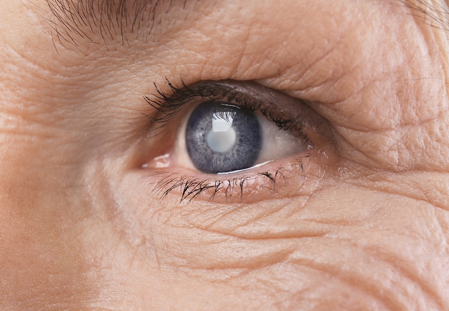 glaucoma 101